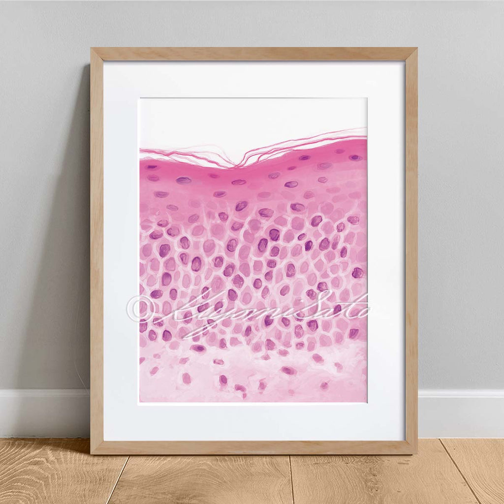 Parakeratosis pathology art print