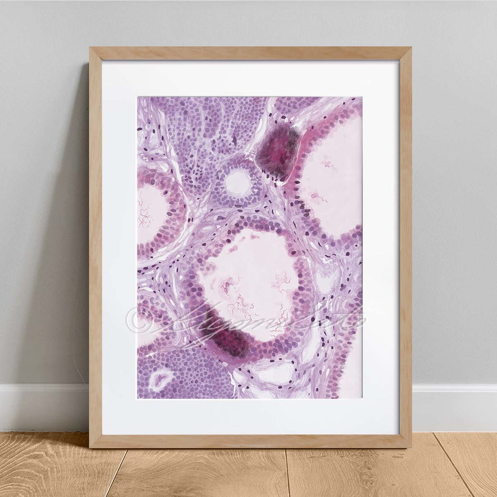 Calcification in the breast Histology Art Poster