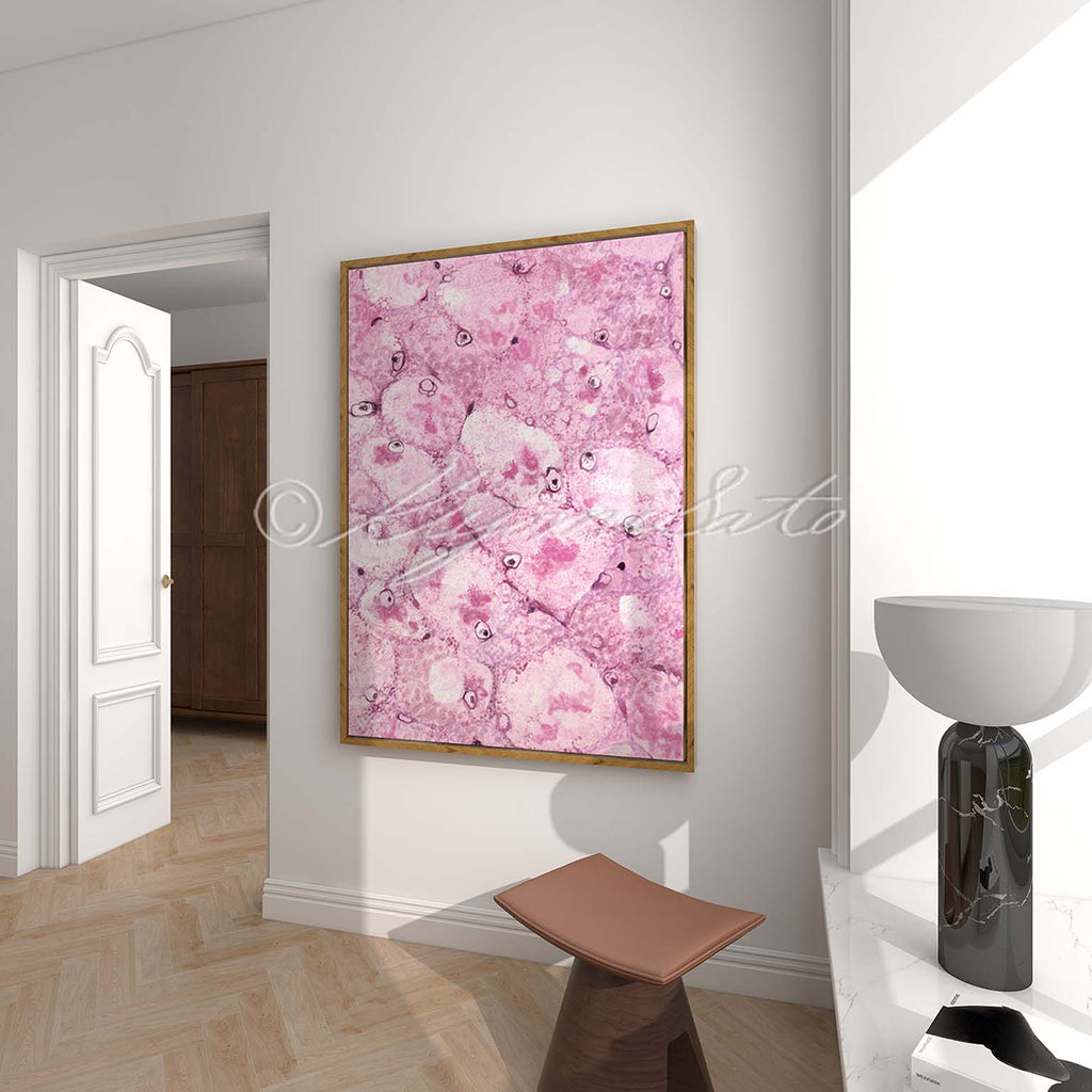 Mallory body Histopathology Art Poster